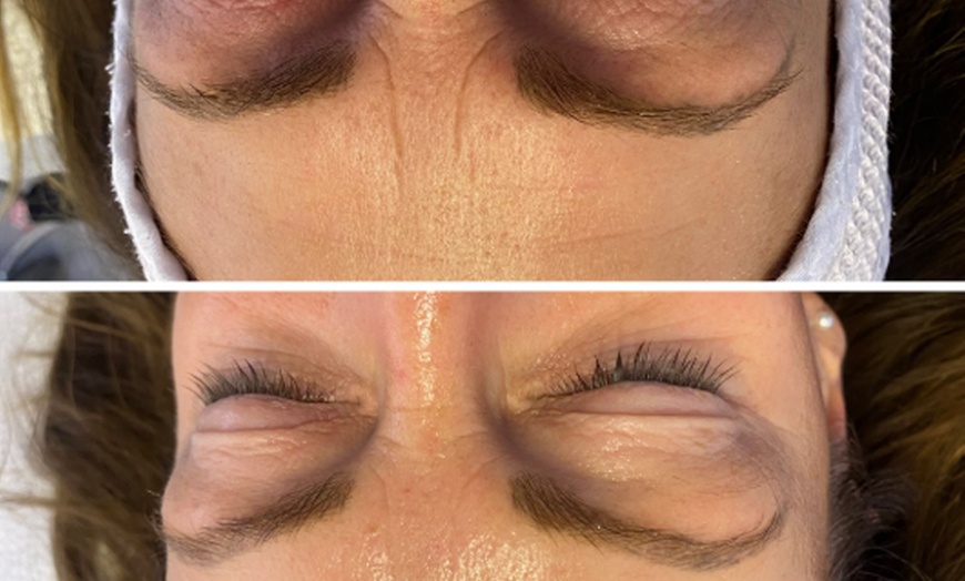 Image 3: 45-75 Min. After Holiday Glow & Serum-Therapie