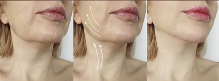 One 60-Minute Lymphatic Facial with Gua Sha and  LED light therapy - W&M Beauty Center