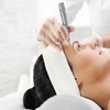 Image 2: Microneedling Treatments for Fine Lines, Wrinkles & Scars