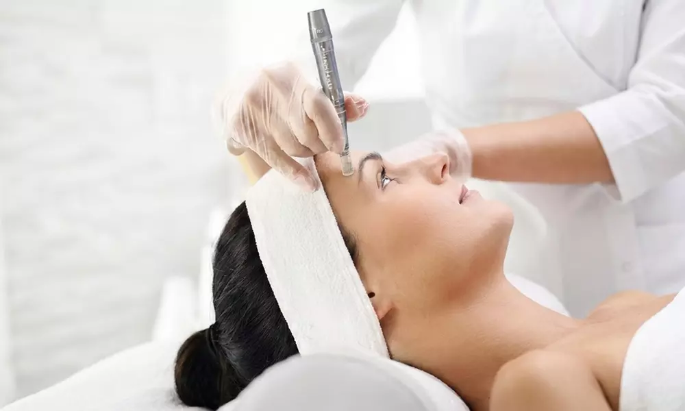 Microneedling Treatments: Reduce Fine Lines, Wrinkles & Scars, with PRP, PDRN, or Stem Cells (Up to 58% Off) - Image 2