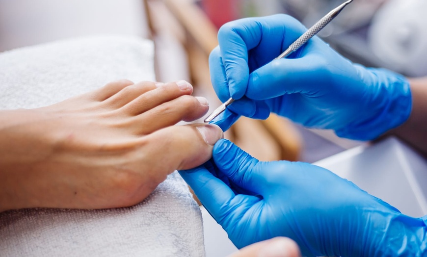 Image 2: Bis zu 55% Rabatt auf den Pediküre bei MRA-PODIATRY