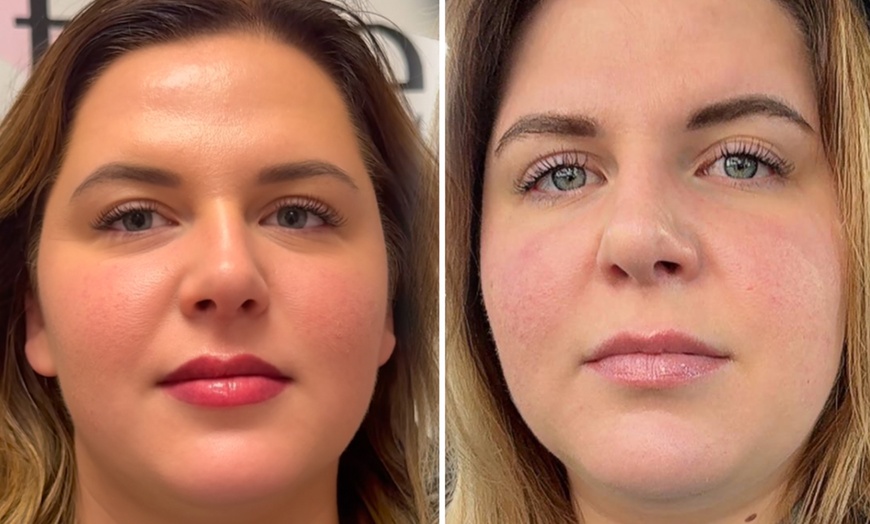 Image 11: Langdurige beauty-upgrades voor je wenkbrauwen, wimpers of lippen