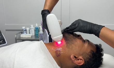 6 Laser Hair Removal Sessions on One Small Area - Bela_and_body