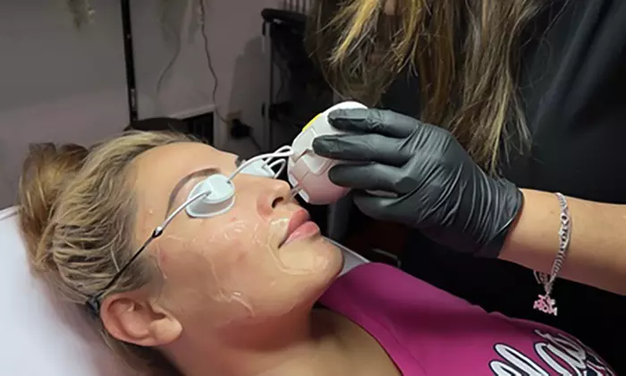 Six Laser Hair Removal Sessions on One Small, Medium, or Large Area