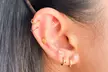 Enhance your wellness with One Med's Jewelry Ear Seeding with 24k Gold or Silver Pellets (Up to 33% Off) - Second Medium