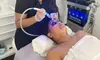 Up to 63% Off on Facial at Zen Body and Skin