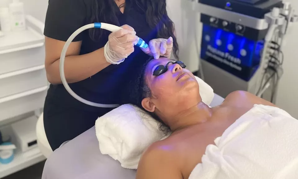 Get a Peptide Rich Hydrofacial, Chemical Peel, or RF Microneedling