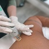Image 1: Smooth Skin: 6 Laser Hair Removal Sessions with Candela GentleMax Pro