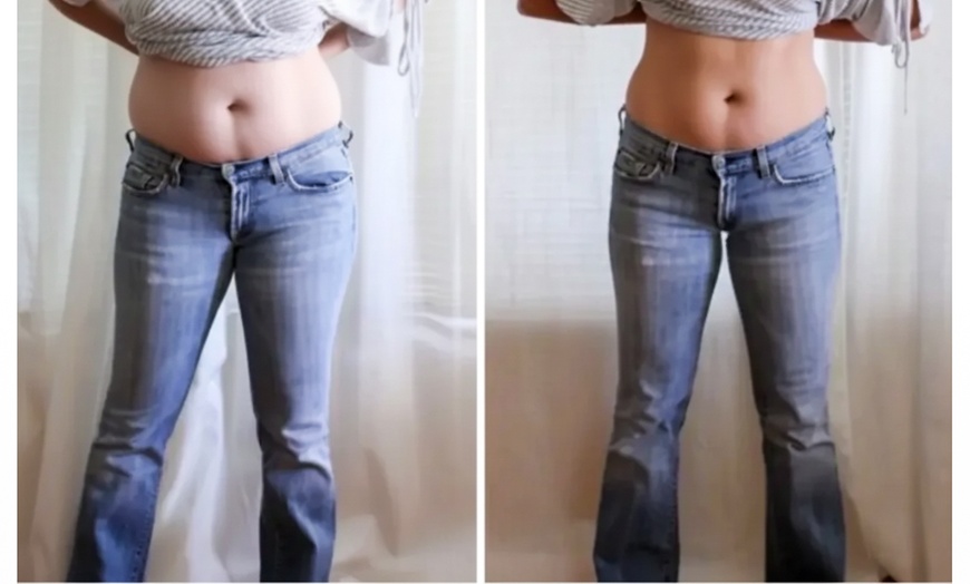 Image 5: Cryolipolysis Treatment