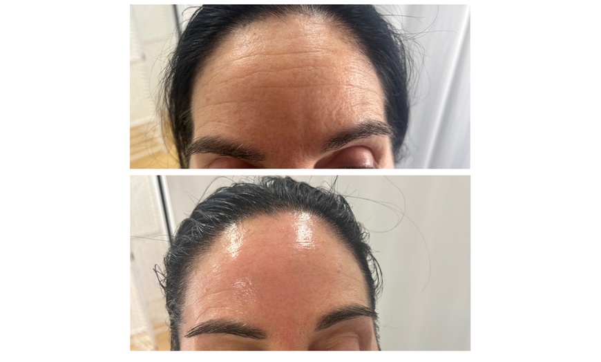 Image 4: Limpieza de cutis manual con tratamiento a elegir para 1 persona