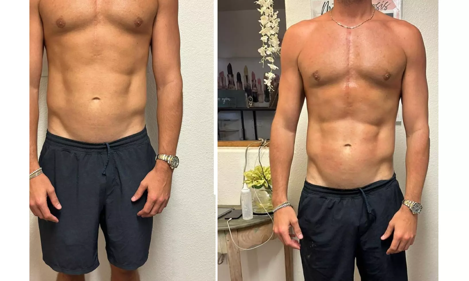 Body Slimming & Wellness — Single, Multi-Session, or Monthly Pass