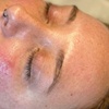 Image 4: One, Two, Three or Four Professional Grade Pro Chemical Peels