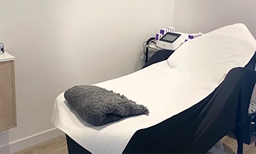 Image 6: Microdermoabrasión con punta de diamante en Cuídate Majadahonda