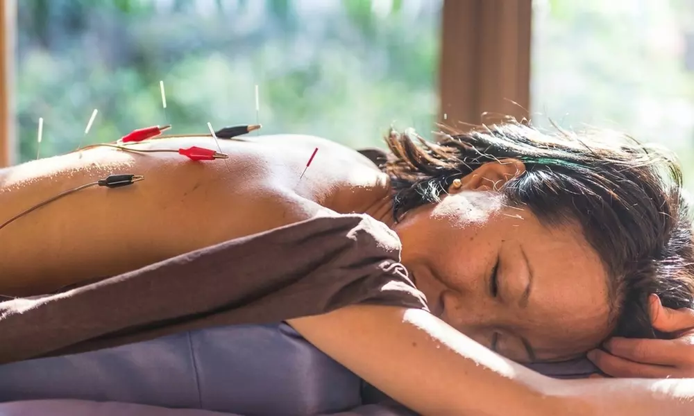 Relax with One  Acupuncture Treatment at Breathe Acupuncture and Wellness (Up to 50%Off) - Primary Image
