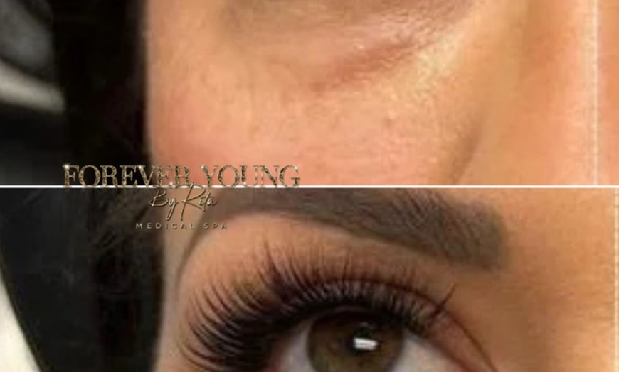 Image 4: One PRF Under Eye Treatment OR One PRF Full Face Rejuvenation