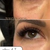 Image 4: One PRF Under Eye Treatment OR One PRF Full Face Rejuvenation