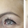 Image 2: 20, 40 Units of Botox or a Syringe of Juvederm Injections
