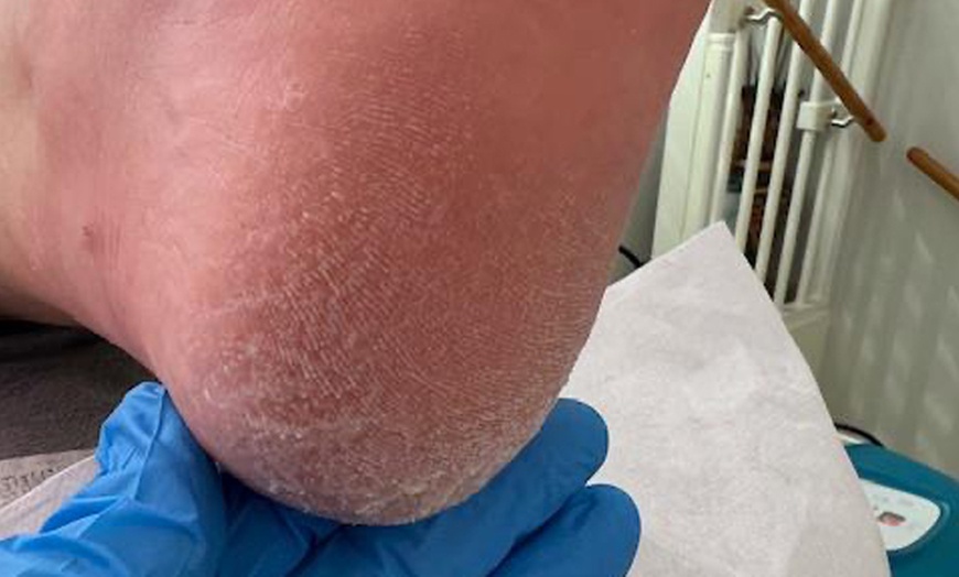 Image 3: Verzorgende pedicure met ontspannende massage & verzorgde afwerking