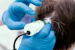 (Up to 55% Off) Laser Hair Restoration Consultation + Optional Treatment Sessions or ROST Scalp Therapy - Second Medium