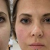 Image 3: The Gold Standard in Renewal: PRP & PRF Plasma Treatments at Artem 