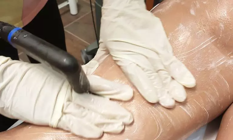 Radiofrecuencia INDIBA