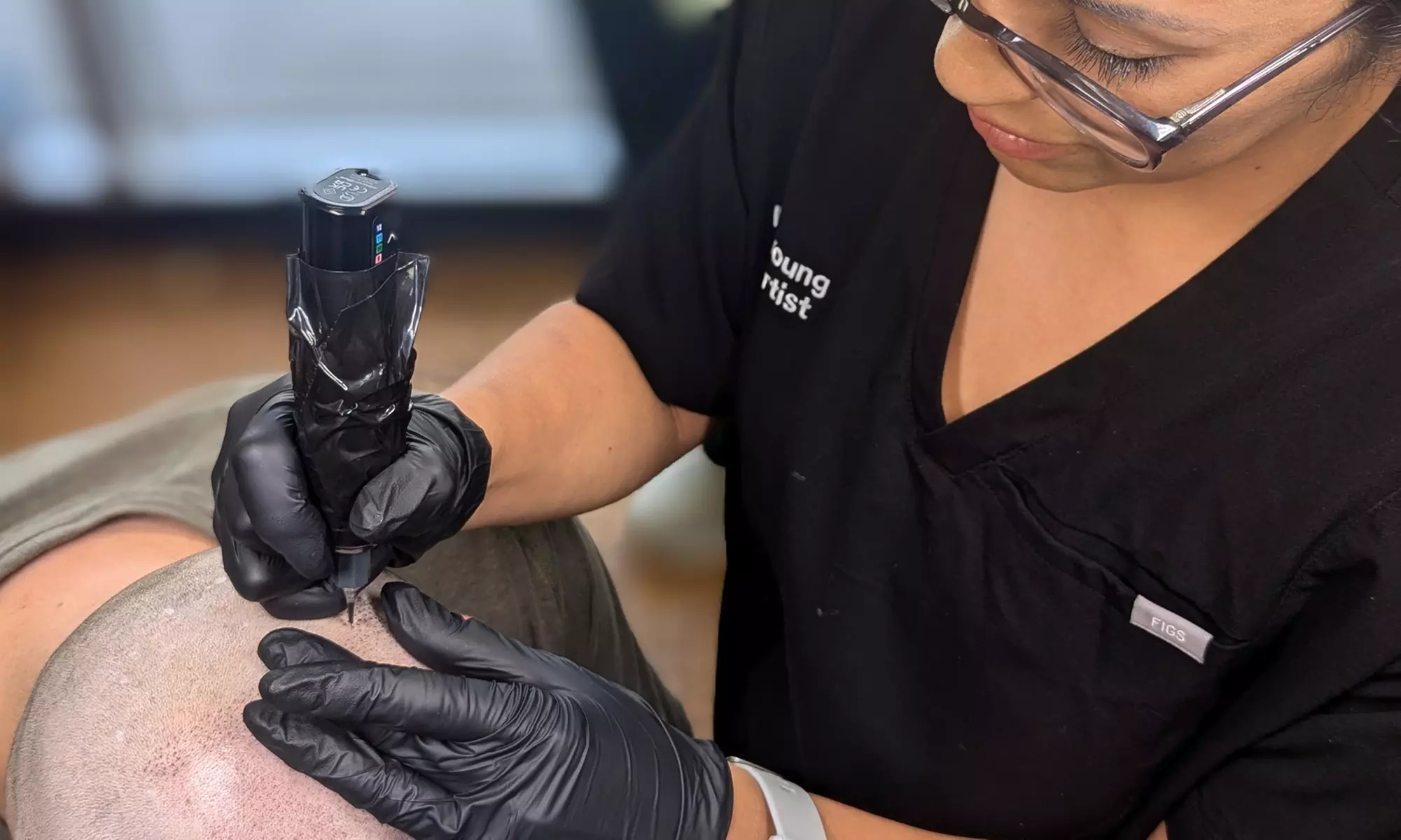 Scalp Micropigmentation Hair Loss, Balding, or Thinning Treatment