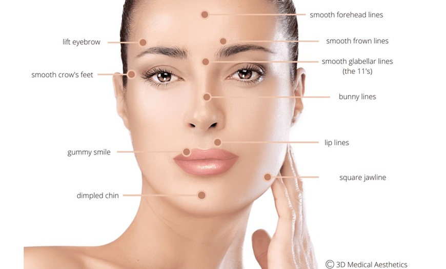 Image 3: Achieve Youthful Skin with Units of Botox