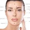 Image 3: Achieve Youthful Skin with Units of Botox