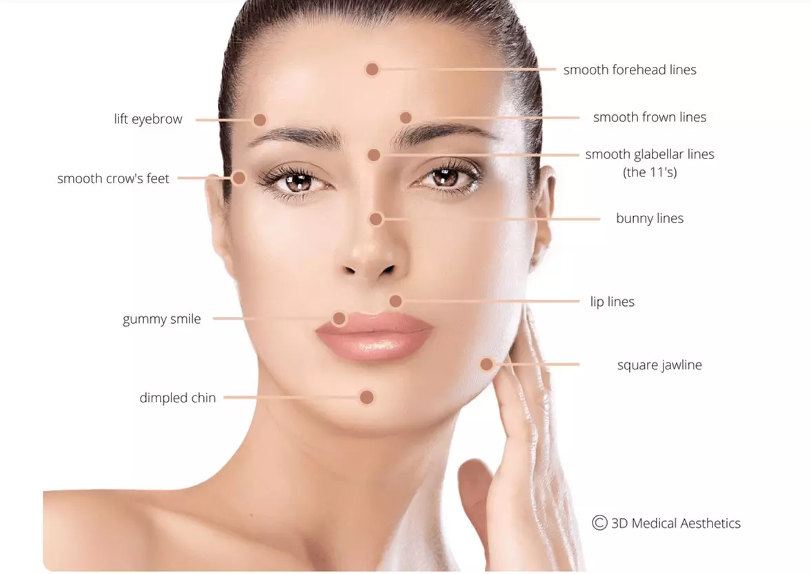 Achieve Youthful Skin with 20, 40, or 60 Units of Botox