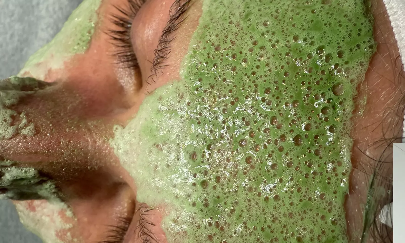 Get the Youthful Glow with Specialized Anti Aging Skin Treatment