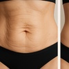 Image 3: Get VIP Tighten & Tone Membership,Total Face & Body Renewal Package 