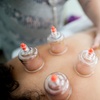 Image 6: Relax and Rejuvenate with Reflexology and Cupping Sessions