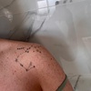 Image 3: Three or Six Sessions of Laser Tattoo Removal, Consultation, & Patch Test at Faded Laser Clinic (Up to 83% Off)