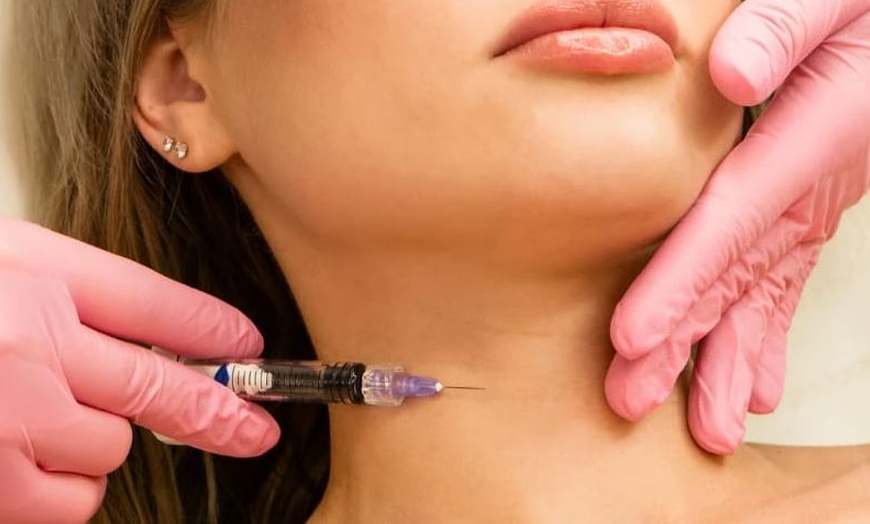 Image 2: Lippenunterspritzung oder Faltenbehandlung mit Hyaluron für 1 Person