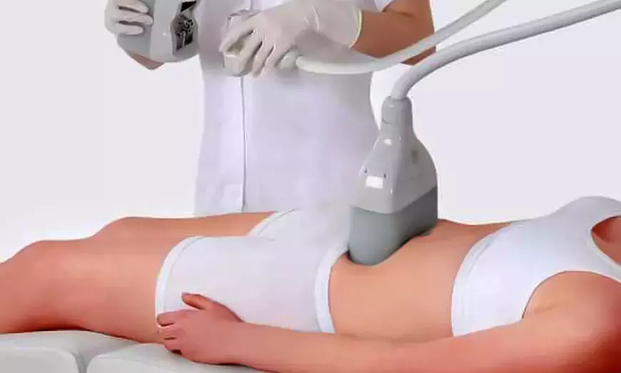 1 ou 3 séances de cryolipolyse sur 1 zone au choix (jusqu'à 47% de remise) - Primary Image