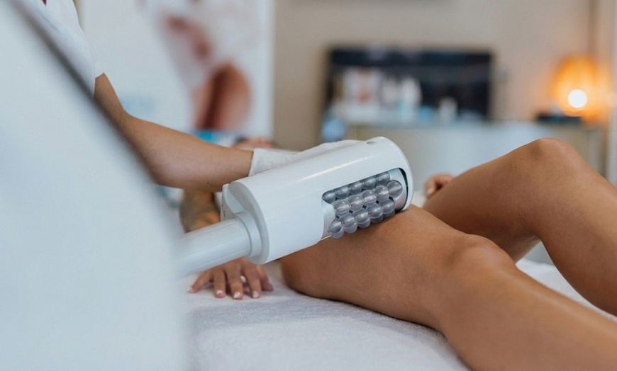 Image 4: Cryo T Shock Fat Freezing Options: 1–5 Sessions w/ Optional Endosphere