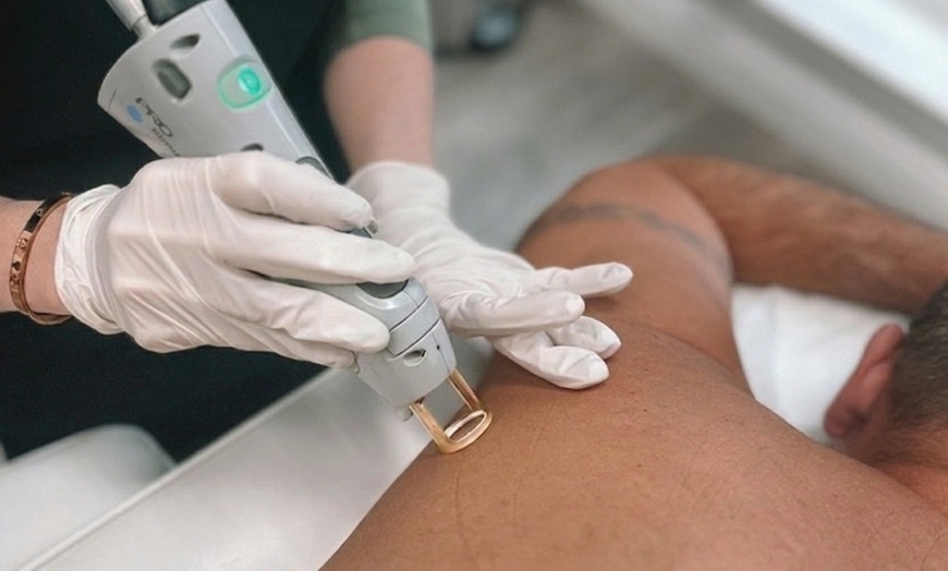 Image 5: Six Sessions of Laser Hair Removal with Candela GentleMax Pro