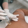 Image 5: Six Sessions of Laser Hair Removal with Candela GentleMax Pro