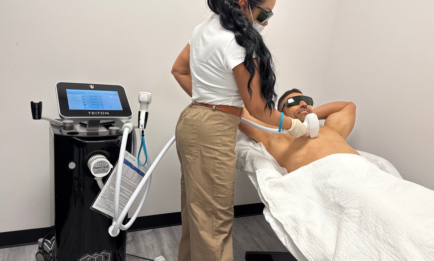 Image 3: Six Sessions or One Year of Unlimited Laser Hair-Removal Sessions