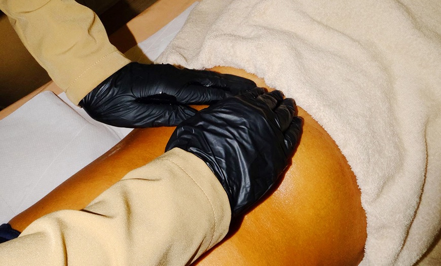 Image 4: 1 of 3 keer laserontharen op zone naar keuze