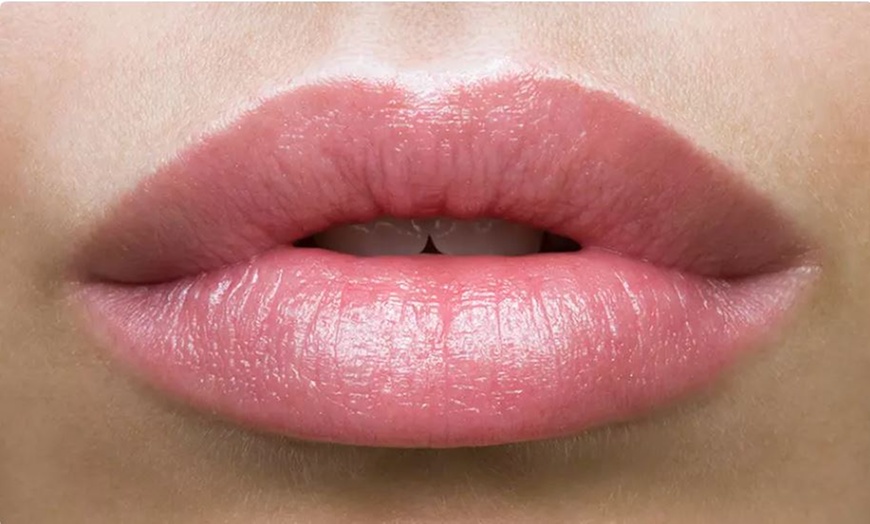 Image 1: Transform Your Look with 1ml or 2ml Dermal Fillers Lip, Cheek or Chin