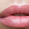 Image 1: Transform Your Look with 1ml or 2ml Dermal Fillers Lip, Cheek or Chin