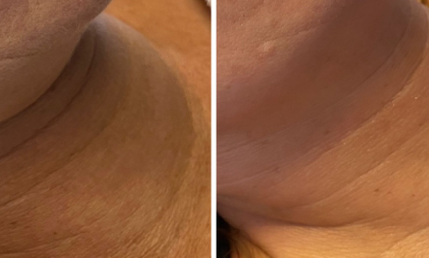 Image 7: 45-75 Min. After Holiday Glow & Serum-Therapie