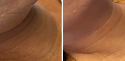 50-70 Min. Weihnachtsglow: HydraBoost-Gesichtsbehandlung für 1 Person