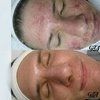 Image 2: Get One, Two, or Three 60 Minute Signature Facial with Smart Peel