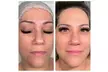 ✨ Glow from Within ✨

PRP Micro-Needling at Beauty Lash – Up to 62% Off Your Skin Revival! - Second Medium