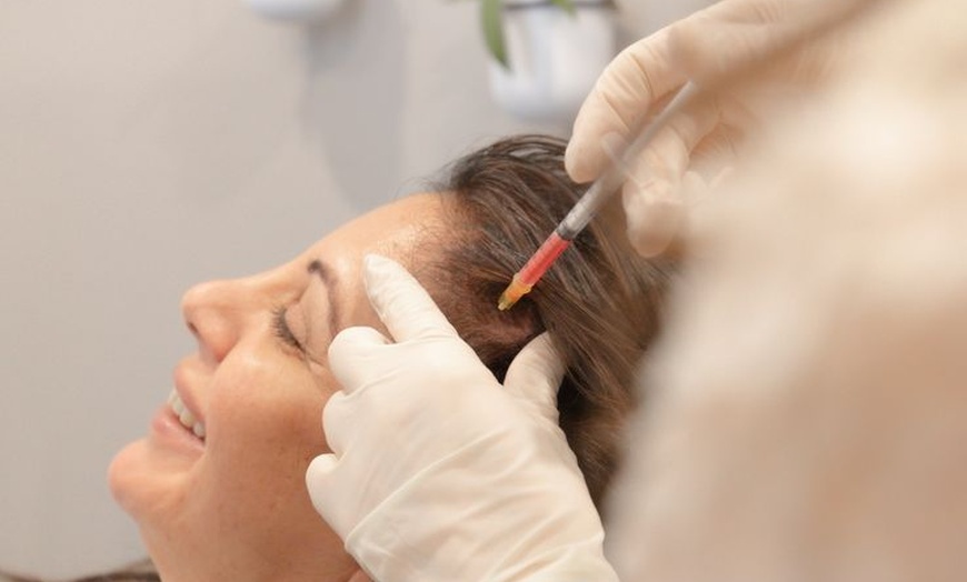 Image 2: Regrow & Revitalize: Up to 47% Off PRP Hair Restoration 

