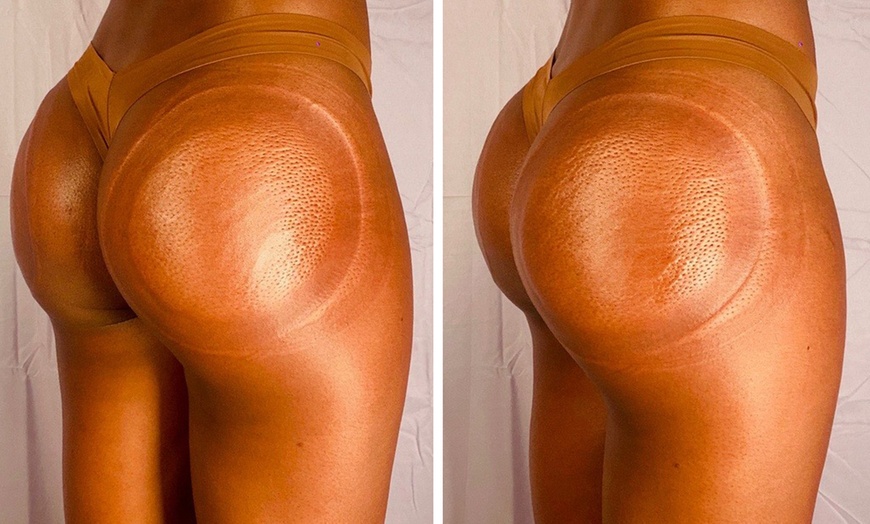 Image 3: Deluxe Lymphatic Drainage & Body Sculpt Sessions