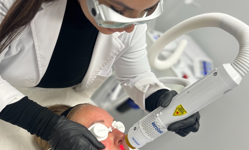 Image 1: 6 Sessions of Aerolase® Neo Elite Laser Hair Removal 
