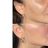 Image 2: Wrinkle-Reducing Injectable Treatment for a Refreshed Look